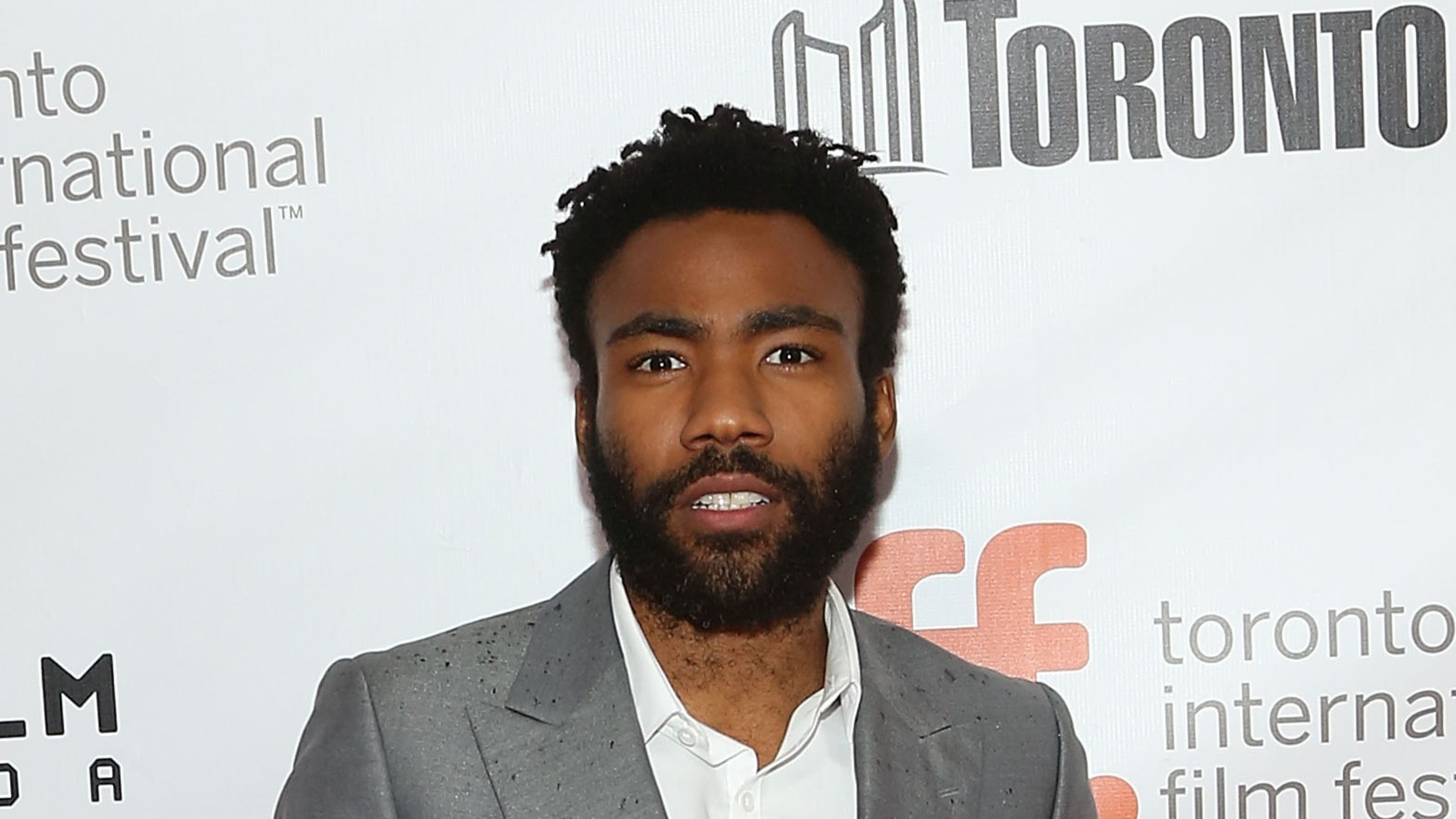 Donald glover hairline